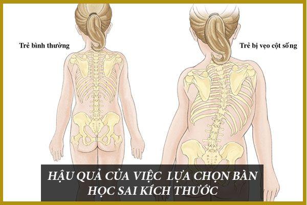 Hình ảnh bài viết