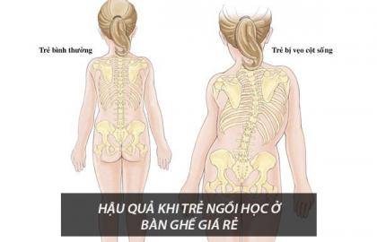 Hậu quả khi mua bàn học trẻ em giá rẻ ở địa chỉ không uy tín