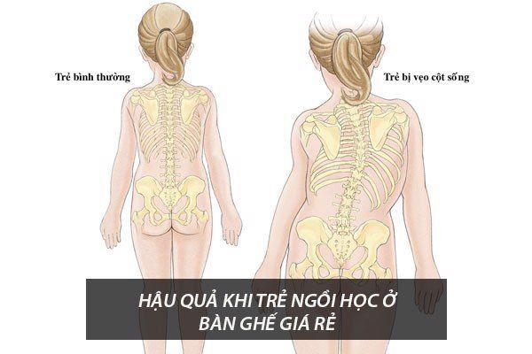 Hậu quả khi mua bàn học trẻ em giá rẻ 